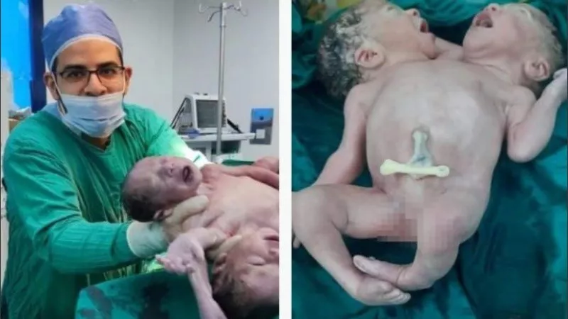 captura.jpg_1756841869