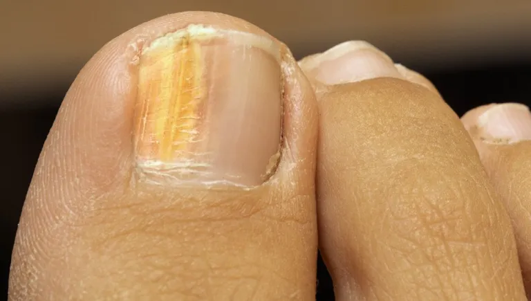 unas-piespng-768x435