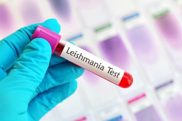 leishmaniasis-visceral-canina-test