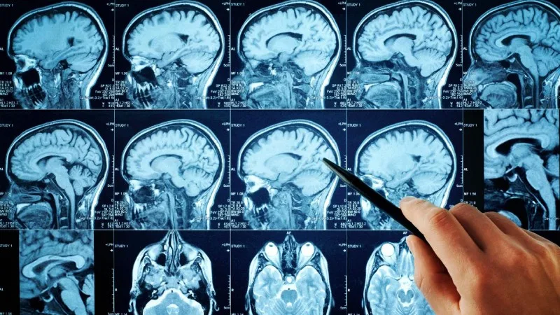 Identifican-por-primera-vez-las-senales-cerebrales-del-olvido-de-recuerdos-desagradables