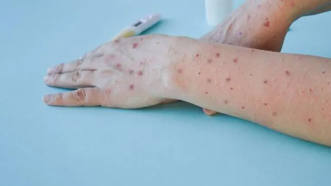 OCA6-ZI7-YNVBUFPDN5-K6-EIIOXL4