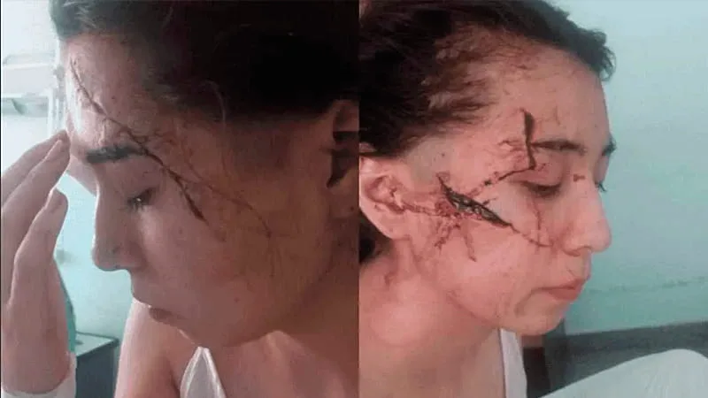 Delfina-la-joven-brutalmente-atacada-a-cuchillazos