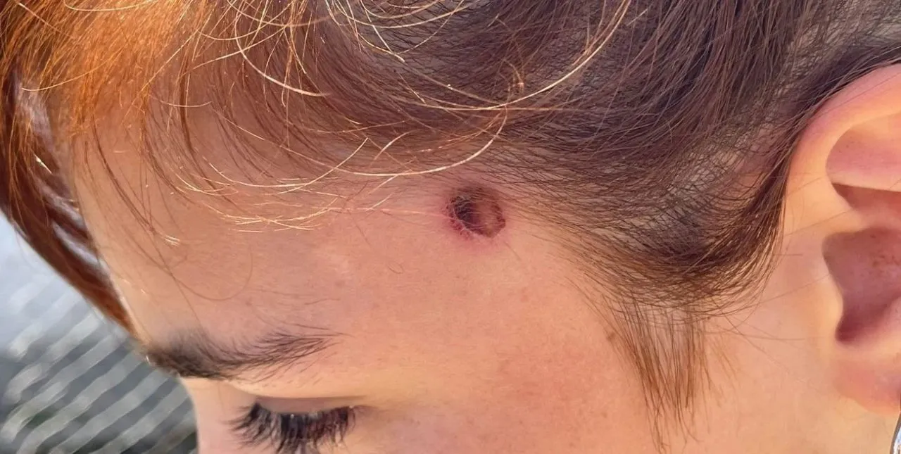 niña-baleada-1280x645