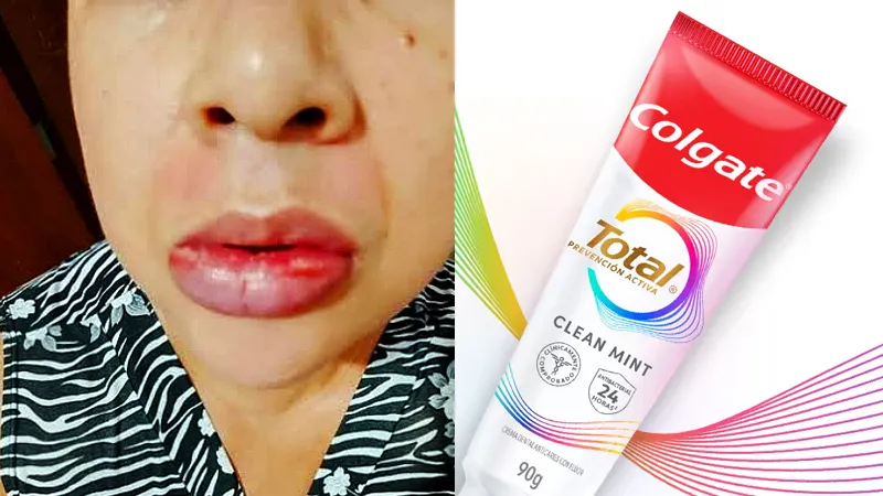 Anmat-prohibio-dentifrico-COLGATE-TOTAL-CLEAN-MINT