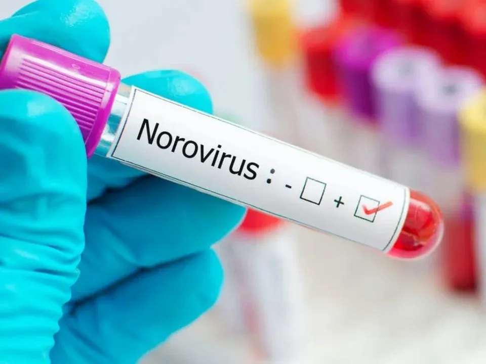 NOROVIRUS