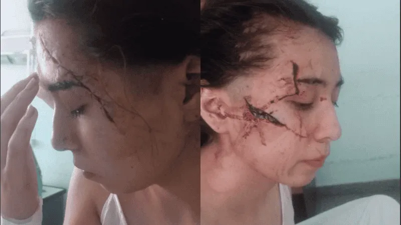 agresion_-1-.png_815021171